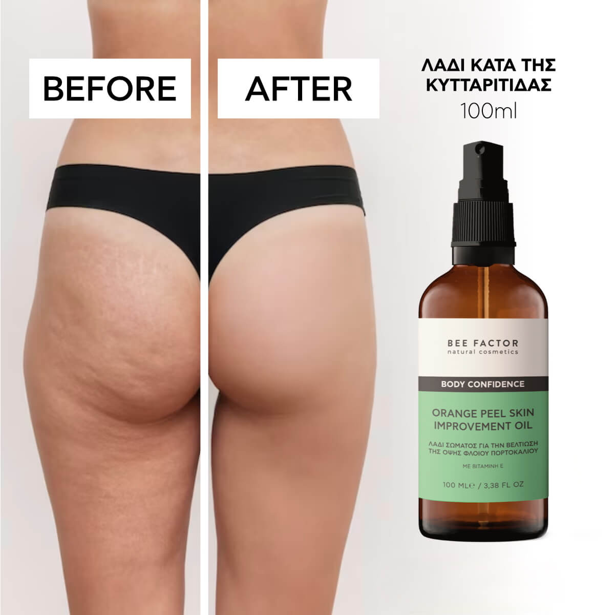 Σετ Λάδι Αδυνατίσματος & Σύσφιξης – Λάδι Κατά Της Κυτταρίτιδας